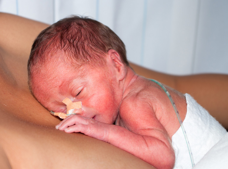  10 reflexiones para afrontar psicológicamente la prematuridad